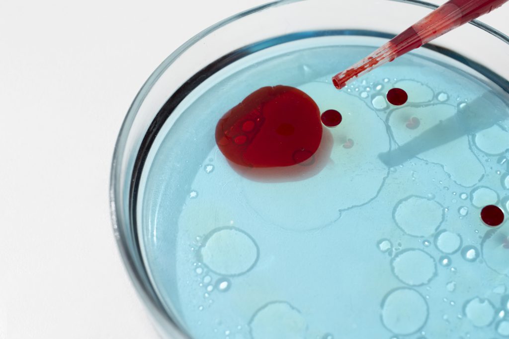 can sickle cell be cured